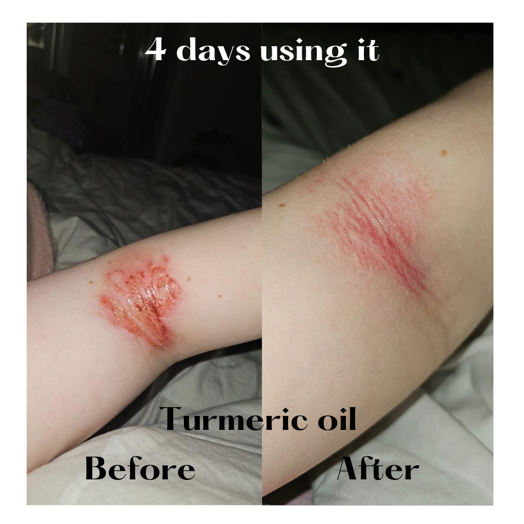 Turmeric Oil